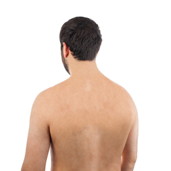 Man facing away with open back
